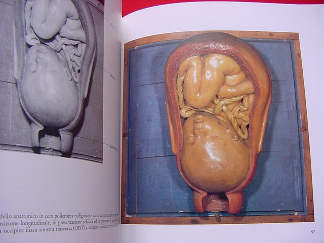LE CERE OSTETRICHE ROMANE DI GIOVAN BATTISTA MANFREDINI LE CERE OSTETRICHE ROMANE DI GIOVAN BATTISTA MANFREDINI