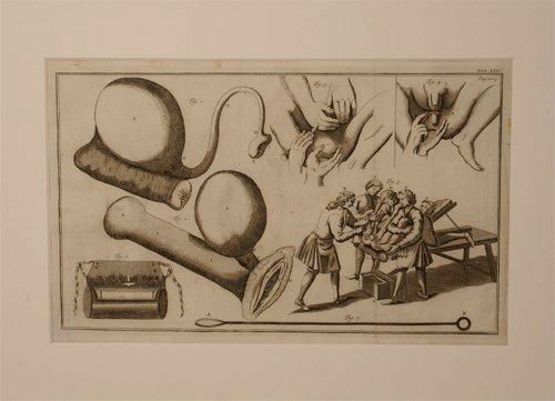 MEDICAL PRINT BY HEISTER L. Heister print – van Leest Antiques 310727-25 MEDICAL PRINT BY HEISTER