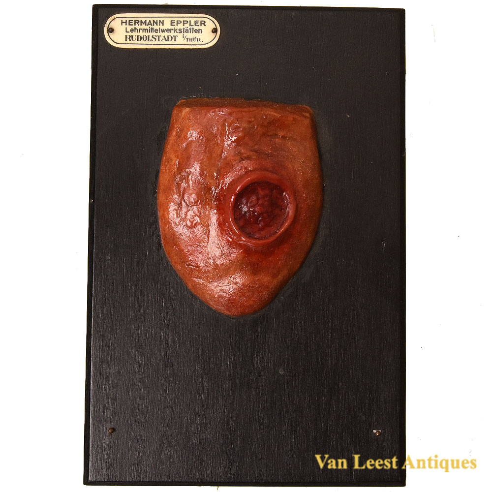 Eppler Anatomical Wax Model tongue Eppler Anatomical Wax Model tongue – Van Leest Antiques (1) Eppler Anatomical Wax Model tongue