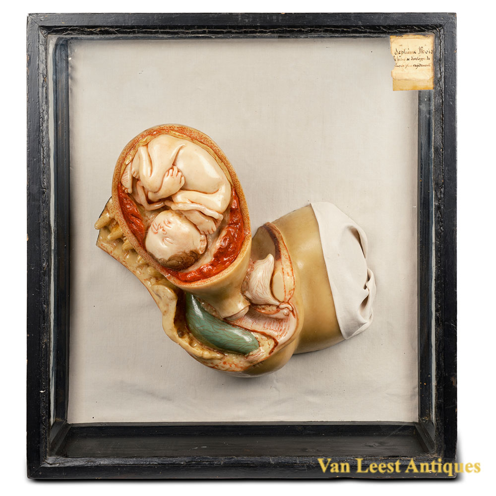Talrich Wax Model Seventh Month Pregnancy Case C 410918 K – Case C – Talrich wax model (2) Talrich Wax Model Seventh Month Pregnancy Case C