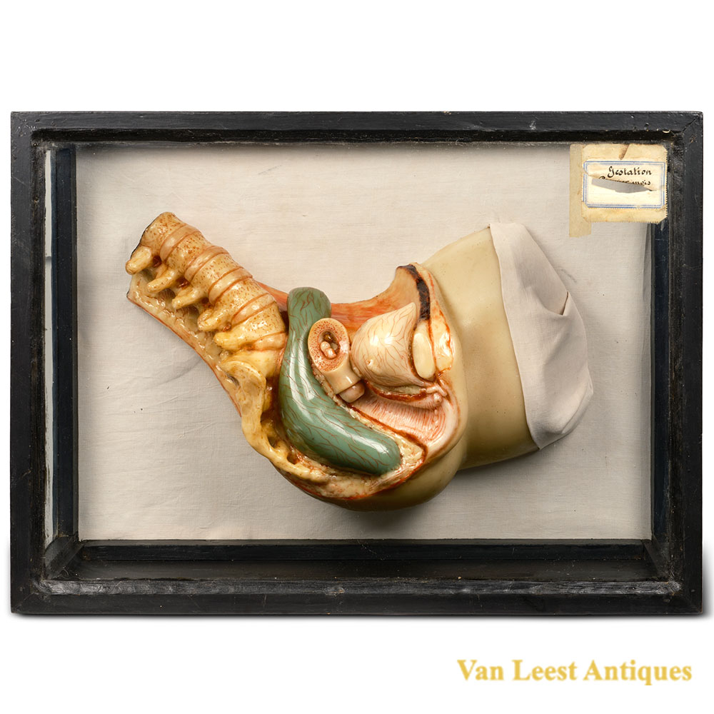 Talrich wax model first month of pregnancy Case B 410918 K – Case B Talrich wax model (2) Talrich wax model first month of pregnancy Case B